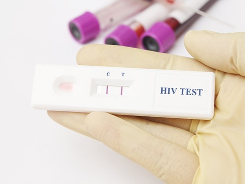 В Резекне будет доступен бесплатный тест на ВИЧ и гепатит